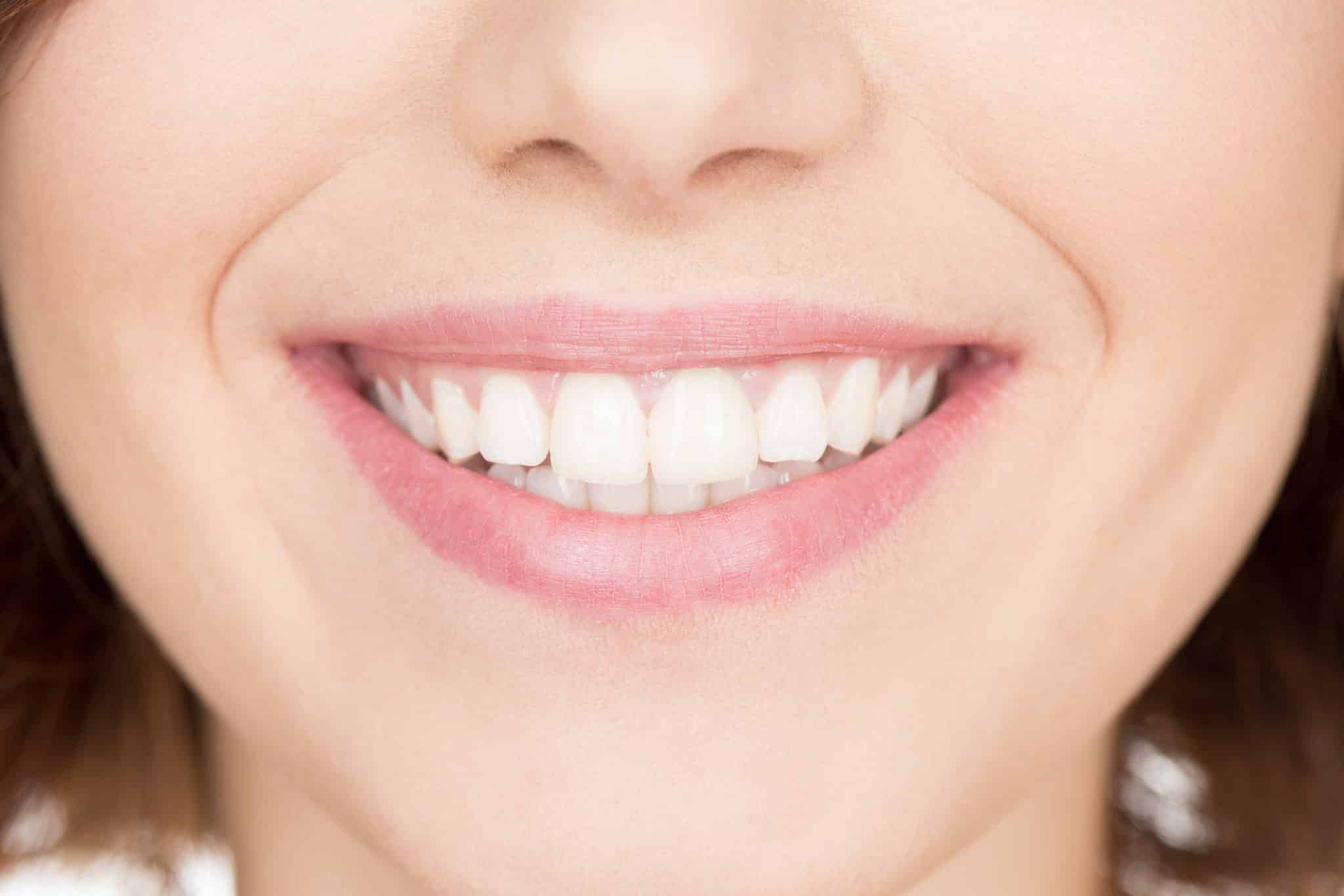 Close-up of woman's smile showing her white teeth