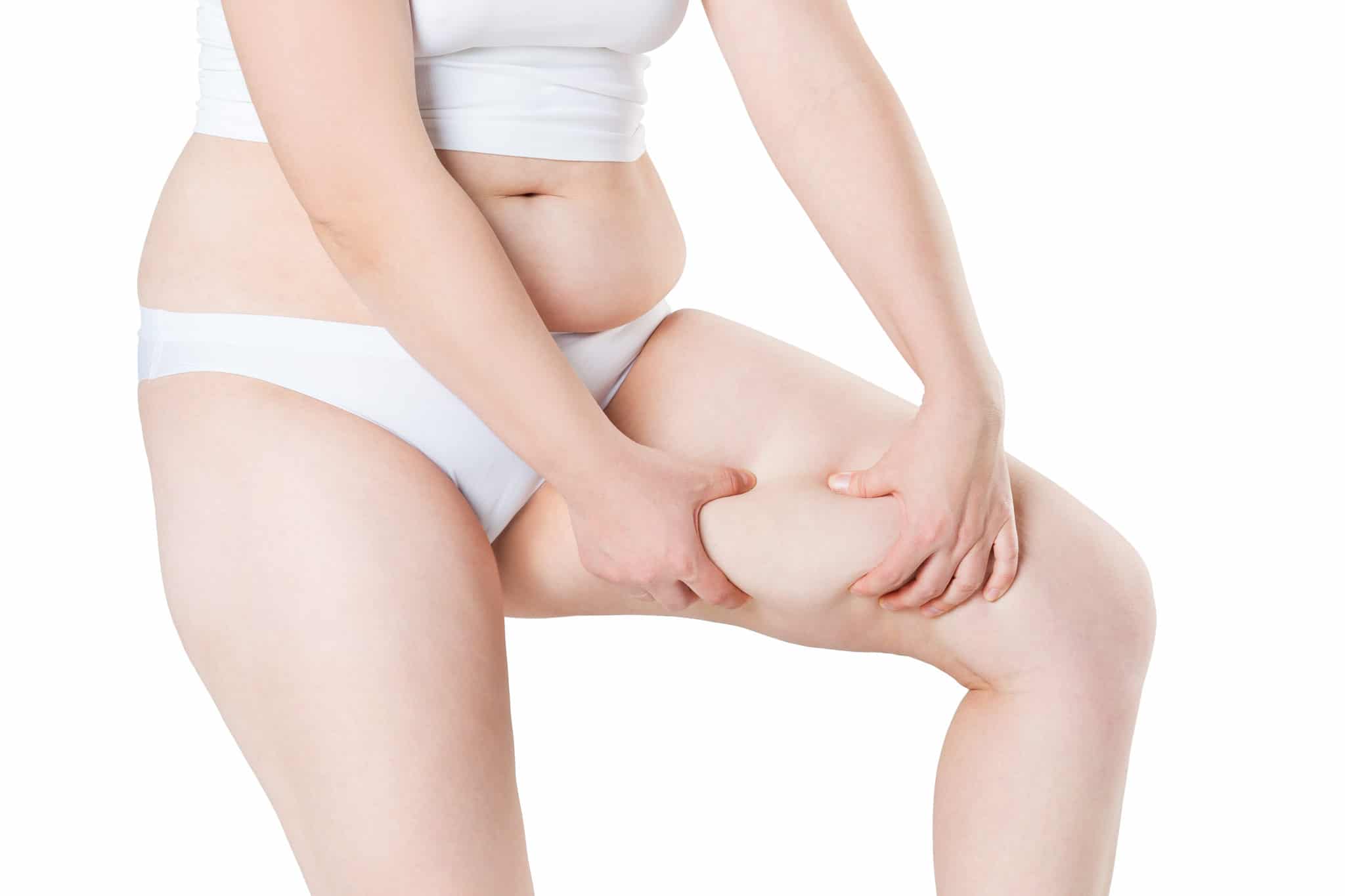 image of woman grabbing inner thigh fat