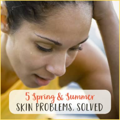 Don't let greasy skin or sunburn get you down.