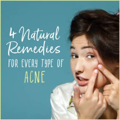 Acne and pimples are a major bust; find out why you may be having issues and how you can fix them, naturally!